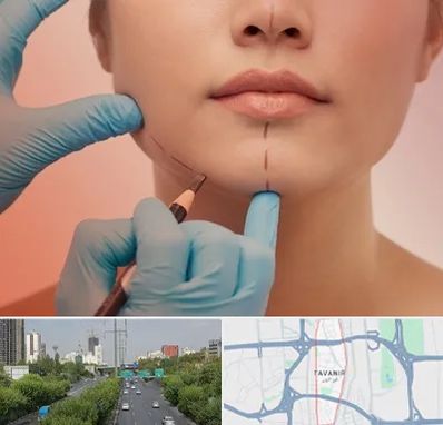 دکتر زیبایی خانم در توانیر