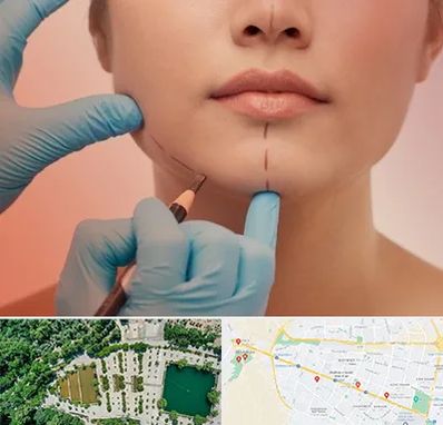 دکتر زیبایی خانم در وکیل آباد مشهد 