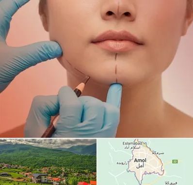 دکتر زیبایی خانم در آمل