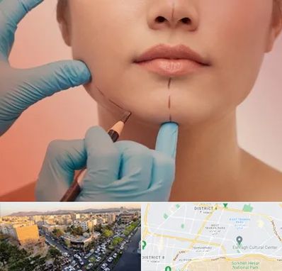 دکتر زیبایی خانم در تهرانپارس 