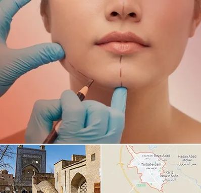 دکتر زیبایی خانم در تربت جام