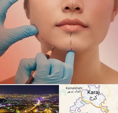 دکتر زیبایی خانم در کرج