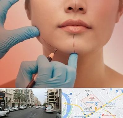 دکتر زیبایی خانم در زیتون کارمندی اهواز 