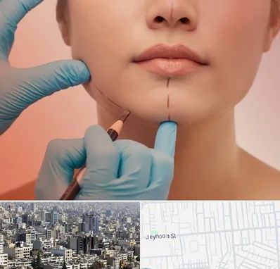 دکتر زیبایی خانم در جیحون