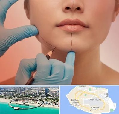 دکتر زیبایی خانم در کیش