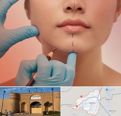 دکتر زیبایی خانم در ایرانشهر