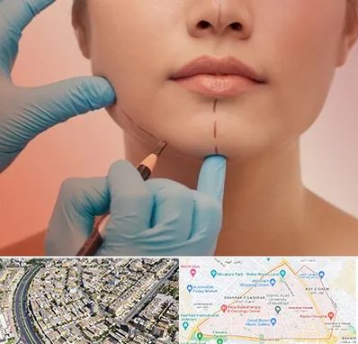 دکتر زیبایی خانم در شهرک غرب مشهد 