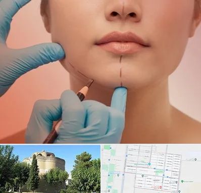 دکتر زیبایی خانم در مرداویج اصفهان 