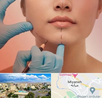 دکتر زیبایی خانم در میانه