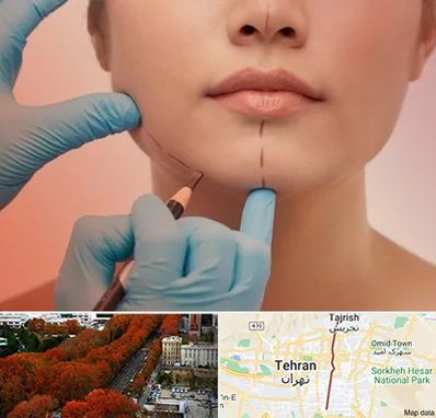 دکتر زیبایی خانم در ولیعصر 