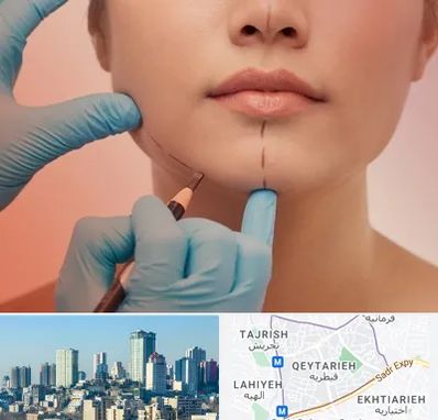 دکتر زیبایی خانم در قیطریه 