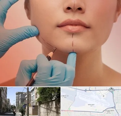 دکتر زیبایی خانم در مهرآباد