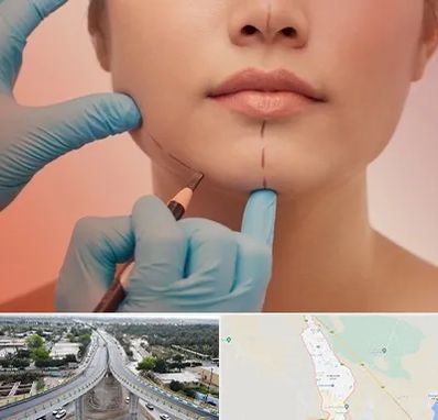 دکتر زیبایی خانم در اندیمشک