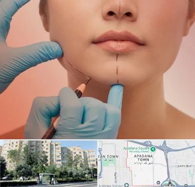 دکتر زیبایی خانم در آپادانا