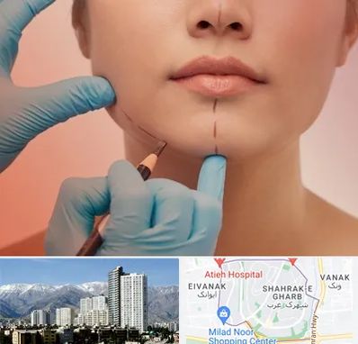 دکتر زیبایی خانم در شهرک غرب 