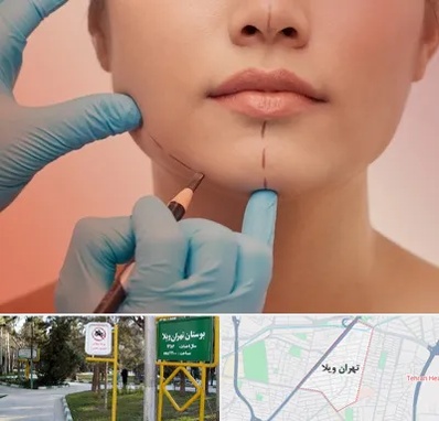 دکتر زیبایی خانم در تهران ویلا