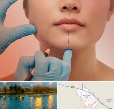 دکتر زیبایی خانم در قروه