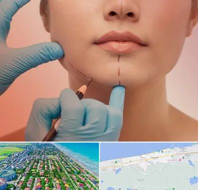 دکتر زیبایی خانم در فریدونکنار