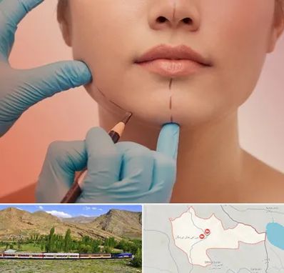 دکتر زیبایی خانم در خاش