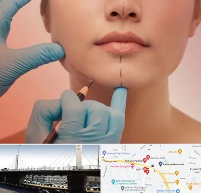 دکتر زیبایی خانم در پارک وی 