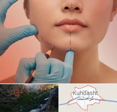 دکتر زیبایی خانم در کوهدشت