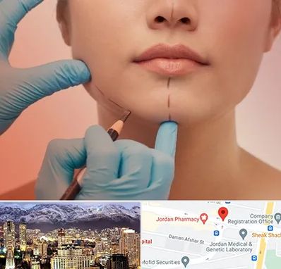 دکتر زیبایی خانم در جردن 