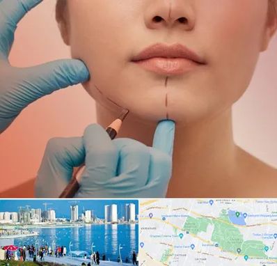 دکتر زیبایی خانم در چیتگر 