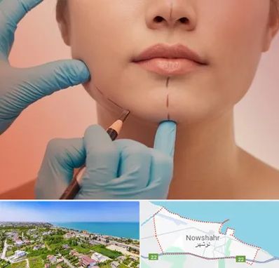 دکتر زیبایی خانم در نوشهر