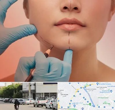 دکتر زیبایی خانم در قدوسی شرقی شیراز 