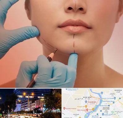 دکتر زیبایی خانم در کیانپارس اهواز 