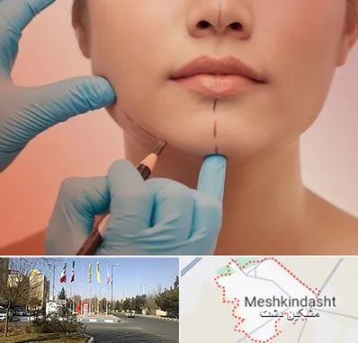 دکتر زیبایی خانم در مشکین دشت