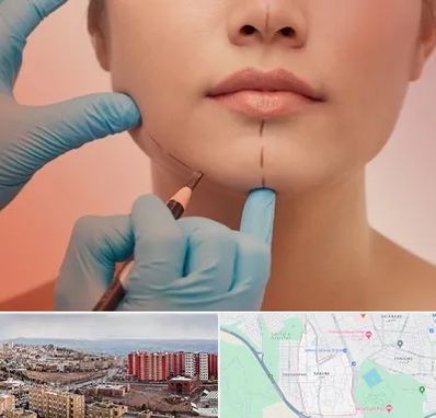 دکتر زیبایی خانم در سهند تبریز