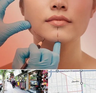 دکتر زیبایی خانم در سلسبیل