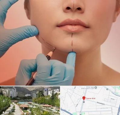 دکتر زیبایی خانم در بلوار تعاون
