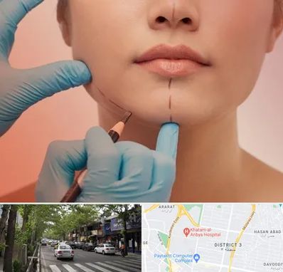 دکتر زیبایی خانم در ظفر 