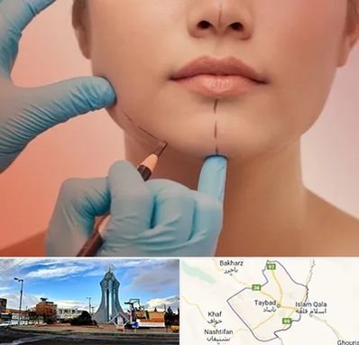 دکتر زیبایی خانم در تایباد