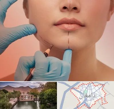 دکتر زیبایی خانم در دامغان