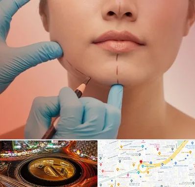 دکتر زیبایی خانم در میدان ولیعصر 