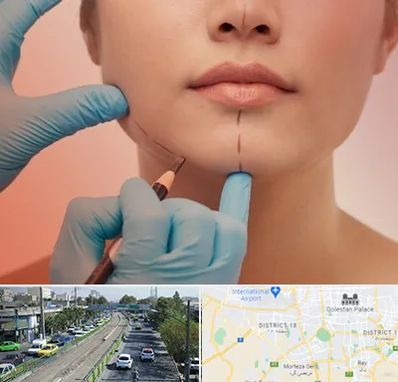 دکتر زیبایی خانم در جنوب تهران 