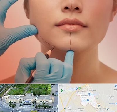 دکتر زیبایی خانم در نسیم شهر