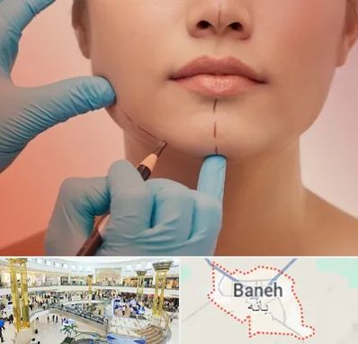 دکتر زیبایی خانم در بانه