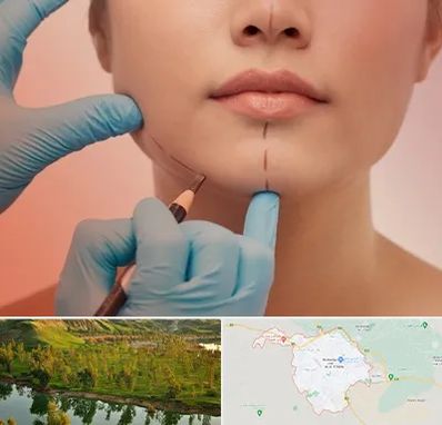 دکتر زیبایی خانم در بهبهان