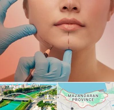 دکتر زیبایی خانم در مازندران