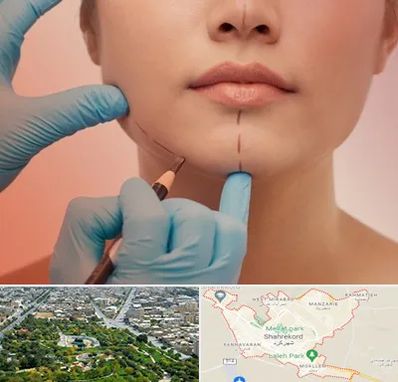 دکتر زیبایی خانم در شهرکرد