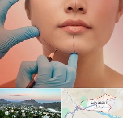 دکتر زیبایی خانم در لواسان