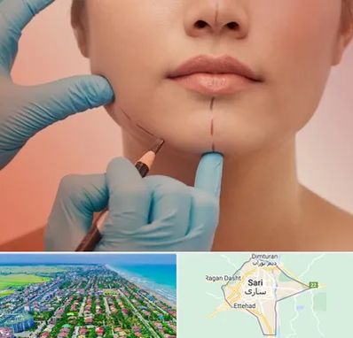 دکتر زیبایی خانم در ساری