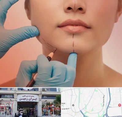 دکتر زیبایی خانم در ایران زمین