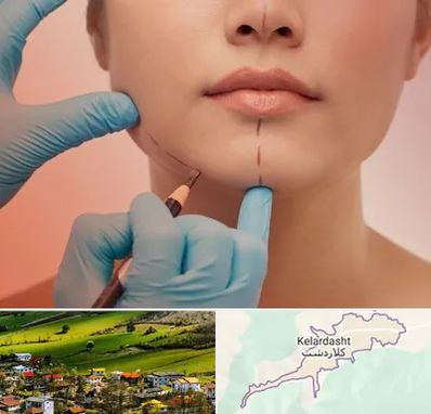 دکتر زیبایی خانم در کلاردشت