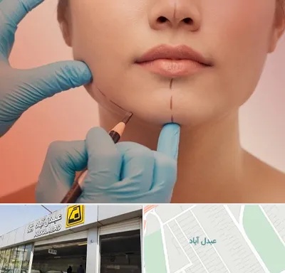 دکتر زیبایی خانم در عبدل آباد