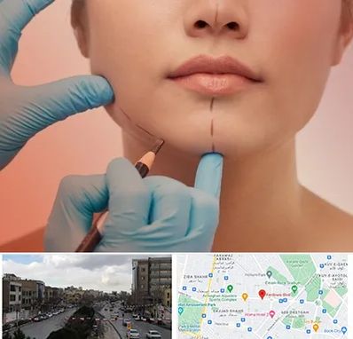 دکتر زیبایی خانم در بلوار فردوسی مشهد 